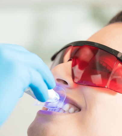 Clareamento Dental