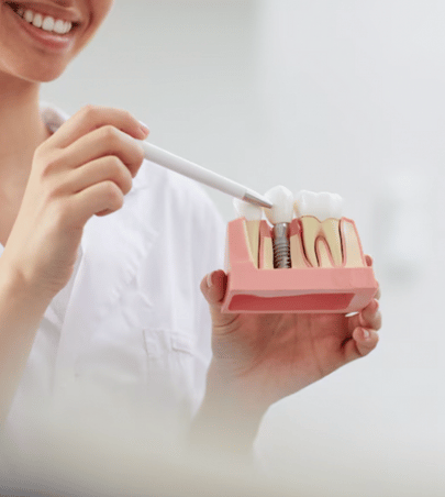 Implante Dentário
